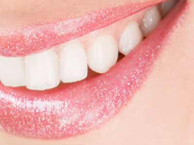 Smile Correction & Smile Design 