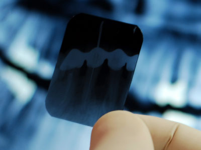  Oral Examination And X-Ray