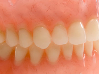 Complete Dentures 